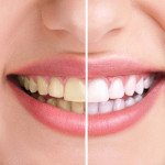 Forever Bright Toothgel – 130gr
